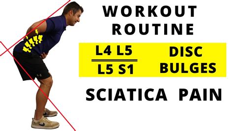 Workout routine for L4 L5 / L5 S1 Disc bulges and Sciatica Pain ...