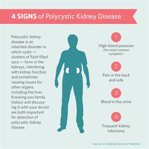 Signs of polycystic kidney disease