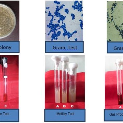 A series of lactic acid bacteria identification tests. | Download ...