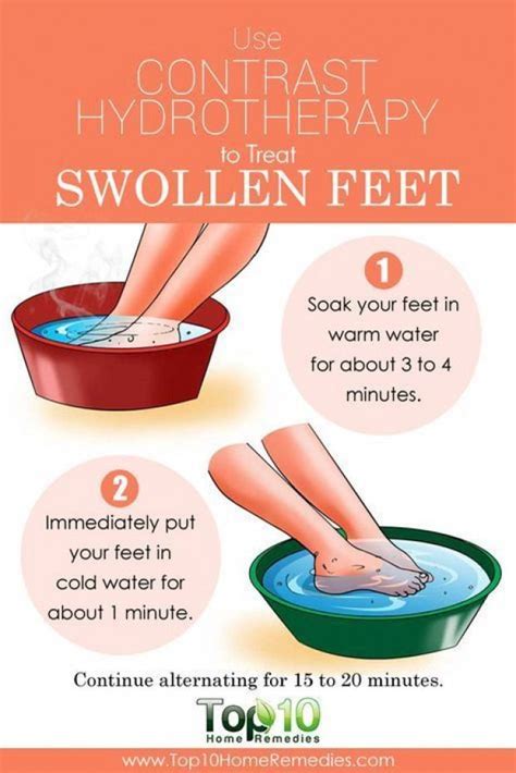 Top 10 Natural Home Remedies for Swollen Feet #JointPainrelief ...