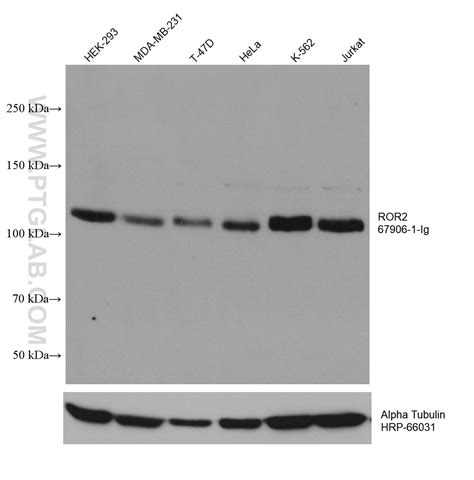 ROR2 antibody (67906-1-Ig) | Proteintech