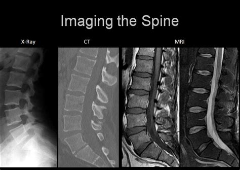 Difference Between Mri And X Ray