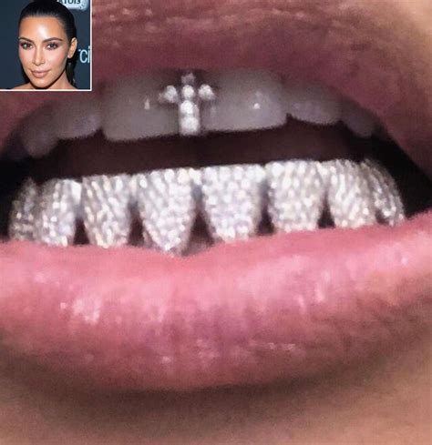 Kanye West Diamond Teeth