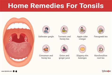 Home remedies for tonsils - By Dr. Rushalli Nair | Lybrate