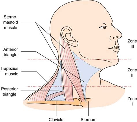 CME 30/03/17 - Penetrating Neck Trauma - Charlie's ED