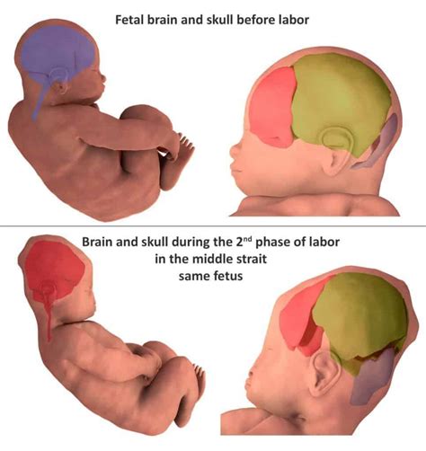 3D scans reveal how an infant's head changes shape during birth