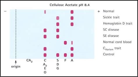 Hemoglobin Electrophoresis Test