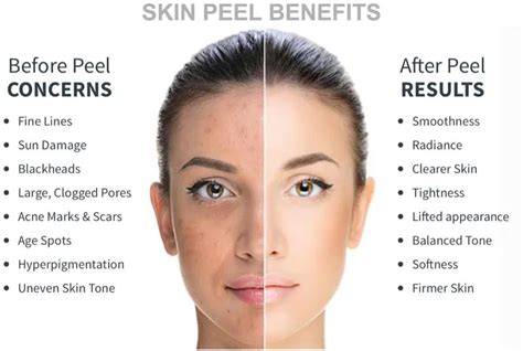 Chemical Peel Staten Island, Regenerate & Brighten the Skin with V ...