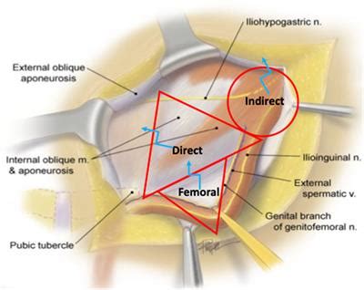 Frontiers Publishing Partnerships | The Role of Releasing Incisions in ...