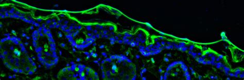 Snapshot: What is Immunofluorescence? - National Ataxia Foundation