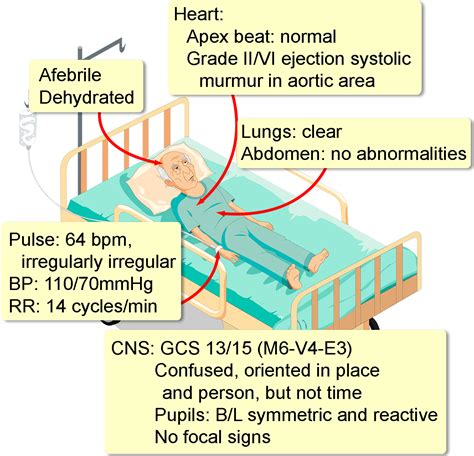 Digoxin Toxicity, Chronic - Interactive case study | Clinical Odyssey ...