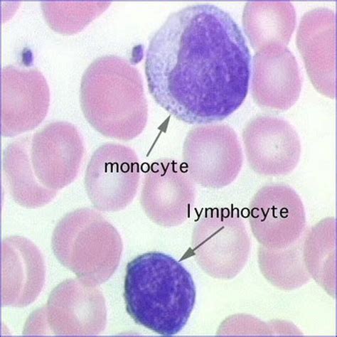 Pin en Hematology Laboratory