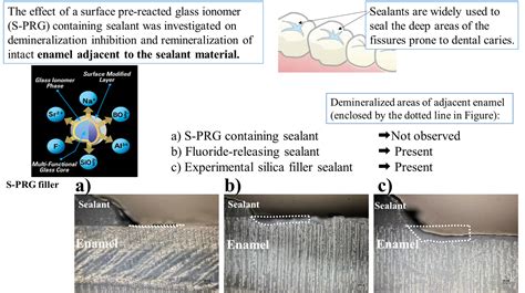 JFB | Free Full-Text | Effect of Surface Pre-Reacted Glass Ionomer ...