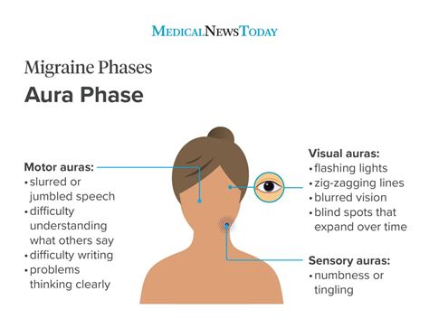 How To Diagnose Migraine - Possibilityobligation5