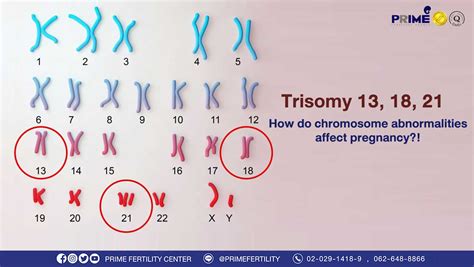 Trisomy 13, 18, 21! How do chromosome abnormalities affect pregnancy?!