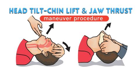 Jaw thrust & Head tilt - Chin lift | maneuver Explanation video - YouTube