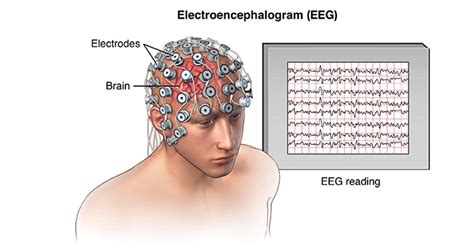 EEG - Electroencephalography