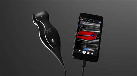 No, This iPhone-Based Ultrasound Doesn't Mean You Should Fire Your ...