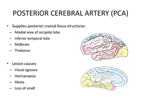 Posterior circulation stroke Syndromes