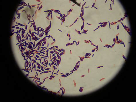 Lactobacillus | Lactobacillus, Lactobacillus acidophilus, Acidophilus