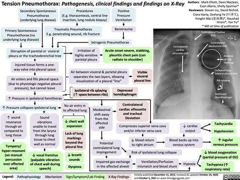 Pneumothorax Patofisiologi Diagnosis Penatalaksanaan Alomedika | The ...