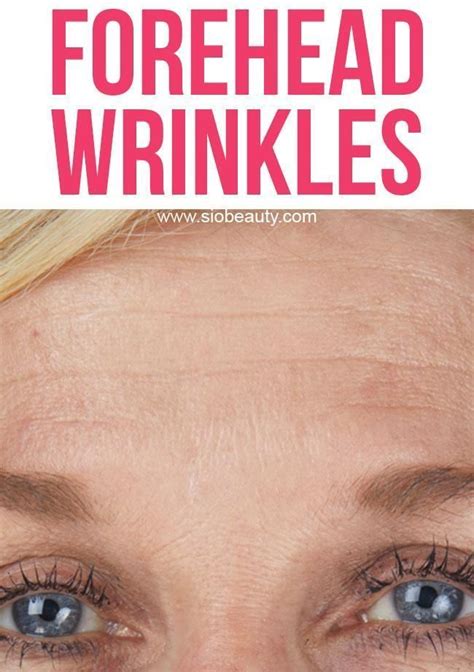 `Here's how you get rid of forehead wrinkles, also known as brow ...