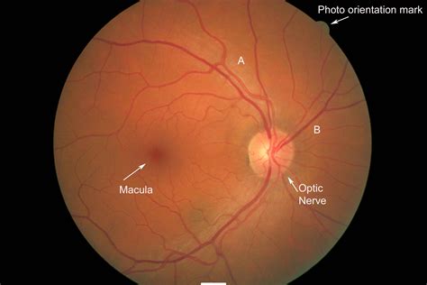 Dr. Berck's Office: Retinal Photography