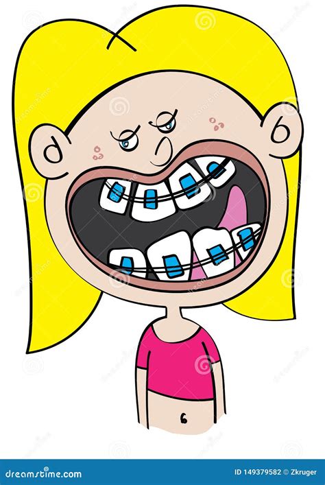 Funny White Girl with Dental Braces Cartoon Stock Vector - Illustration ...