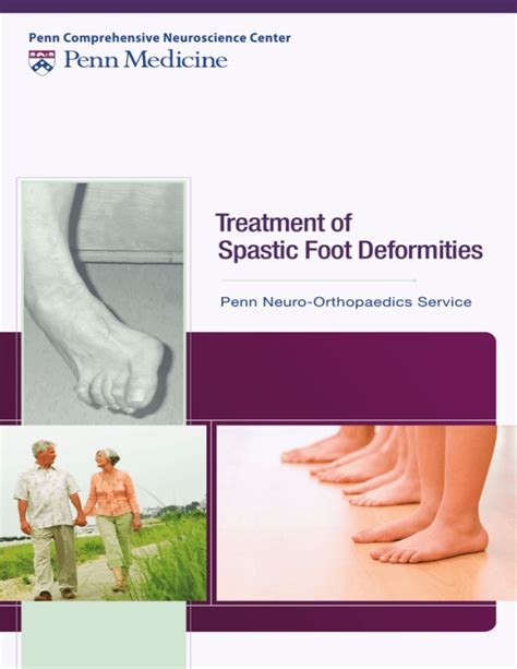 Treatment of Spastic Foot Deformities