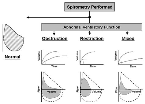 MEDICAL SCHOOL: SPIROMETRY INTERPRETATION | Medical information, Asthma ...