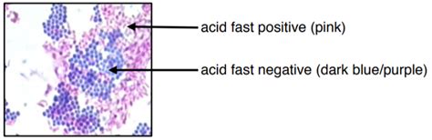 💄 Acid fast stain lab report. Acid. 2022-10-13