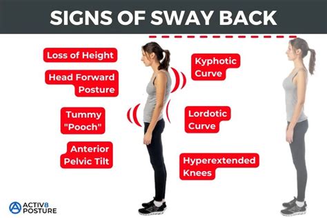 Sway Back - Activ8 Posture