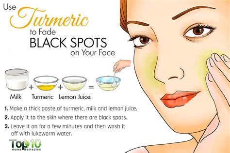 Learn All About Skin Care With These Tips (With images) | Dark spots on ...