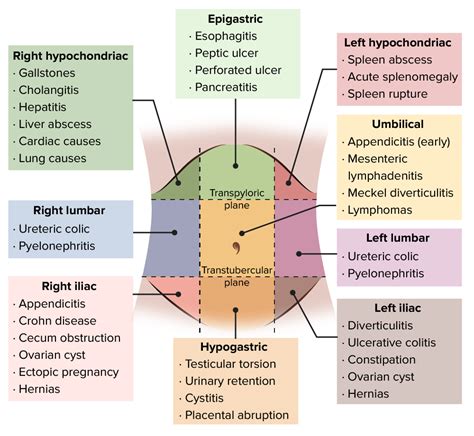 Abdómen Agudo | Concise Medical Knowledge