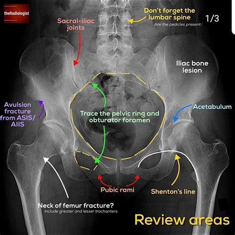 Pin by Danielle Queiroz on Fisioterapia | Radiology student, Medical ...