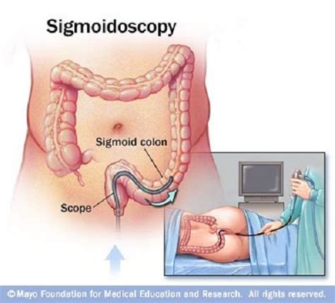 Difference Between | Sigmoid colon, Homeopathy treatment, Microscopic ...