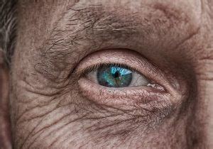 What Is Ocular Ischemic Syndrome: Types, Causes, Tests | Arizona ...