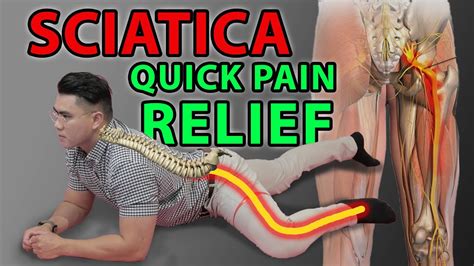 One Minute Sciatica Exercise to Cure Sciatica & Quick Pain Relief | Leg ...