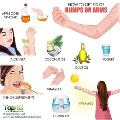 How to Get Rid of Bumps on Arms | Bumps on arms, Skin bumps, Treating ...