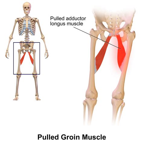 Everything You Need to Know About Groin Strains