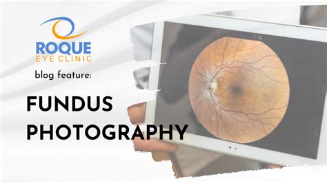 Fundus Photography - ROQUE Eye Clinic | Eye.com.ph