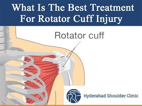 rotator cuff physical therapy in Hyderabad - shoulder clinic Hyderabad