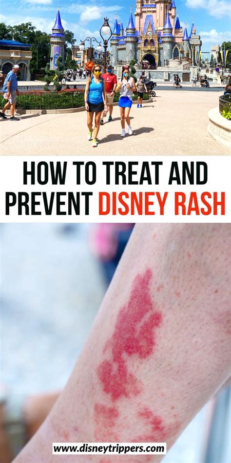 How To Treat And Prevent Disney Rash - Disney Trippers | Disney world ...