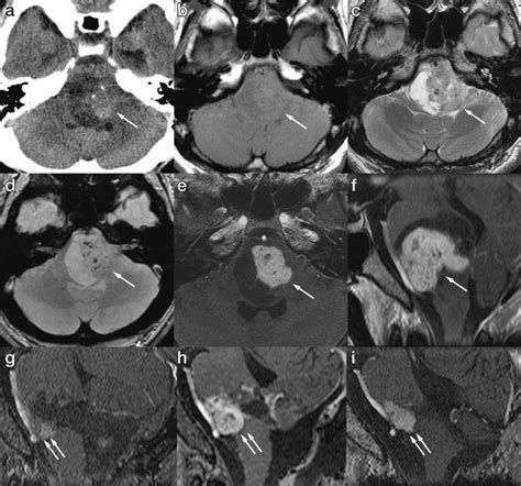 Computed tomography (CT) and magnetic resonance imaging (MRI) performed ...