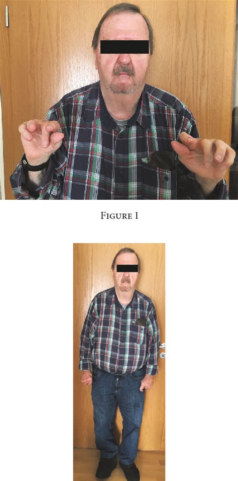 Figure 1 from Anesthetic Considerations for an Adult Patient with ...