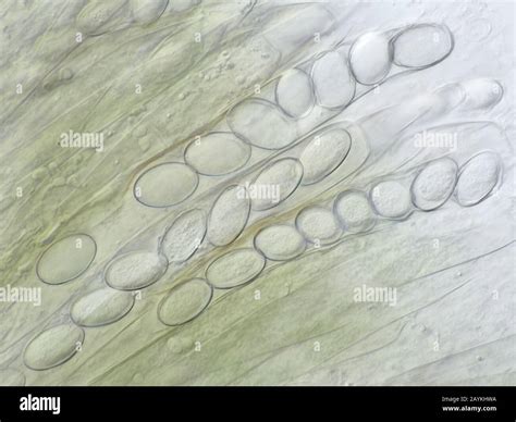 Fungal Spores Under Microscope