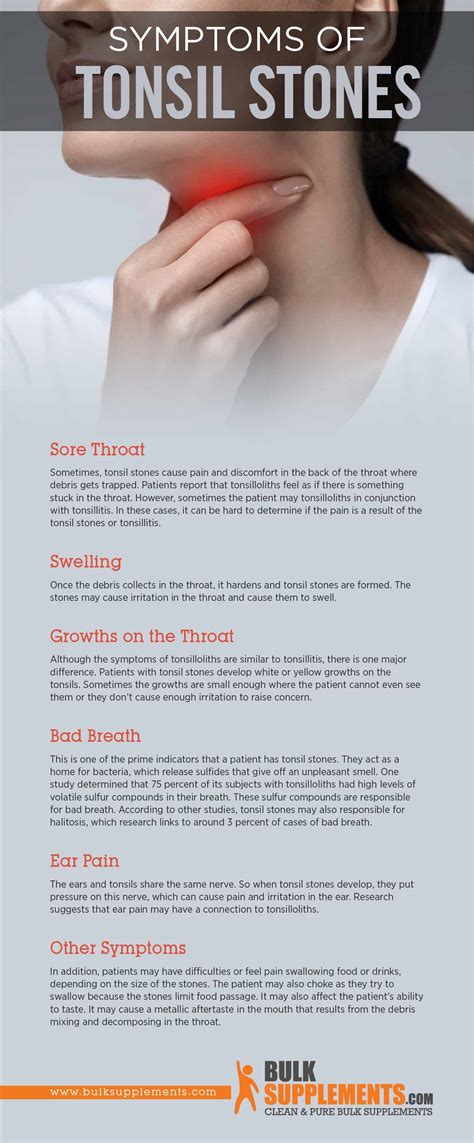 Tablo | Read 'Tonsilloliths (Tonsil Stones): Risk Factors, Symptoms ...