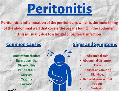 Peritonitis: Causes, Symptoms, Diagnosis Treatment, 60% OFF