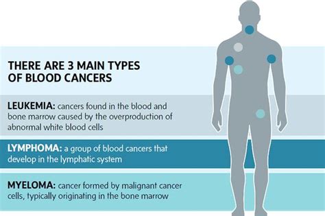 Blood Cancer Types - CancerWalls