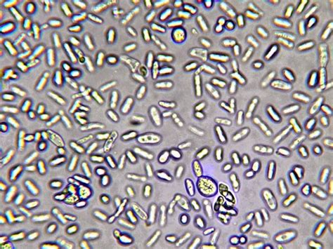 Fun With Microbiology (What's Buggin' You?): Trichosporon species